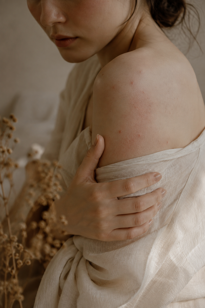 Formulating for the Most Sensitive Skin